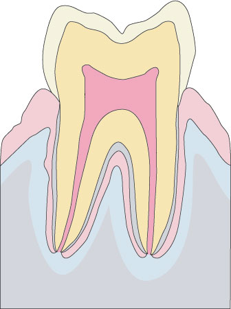 歯と歯肉２７(110500027)