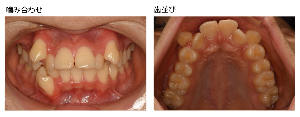 この癖を放っておくと・・・