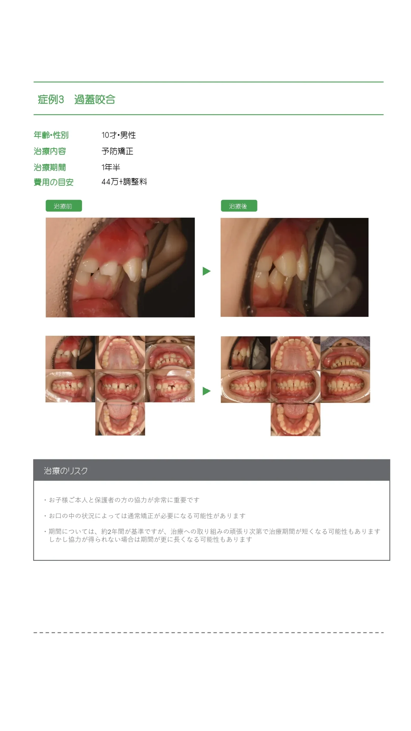 予防歯科症例_1
